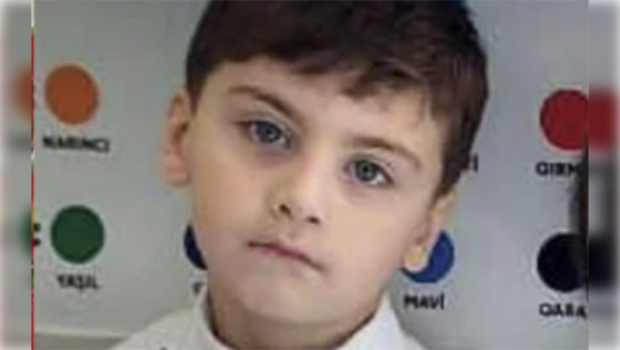 Faciəvi şəkildə ölən 5 yaşlı Aminin FOTOSU
