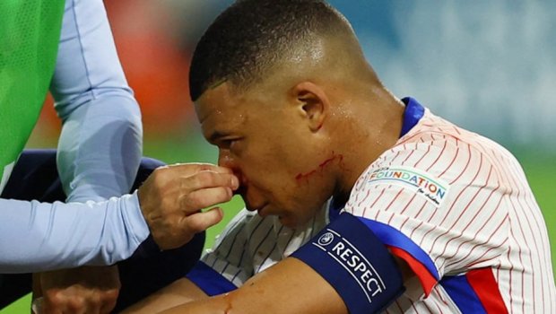 Mbappe qalan matçlarda maska ilə oynayacaq - QİYMƏTİ 1200 AVRODUR