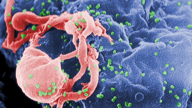 ABŞ-də təhlükəli epidemiya yayıldı - Ölənlər var