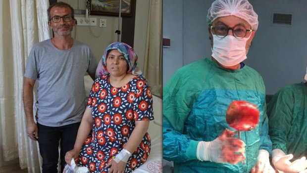 Xəstəxanaya gedən qadın ŞOK keçirdi – Qarnından 1 kq ağırlığında DAŞ çıxarıldı