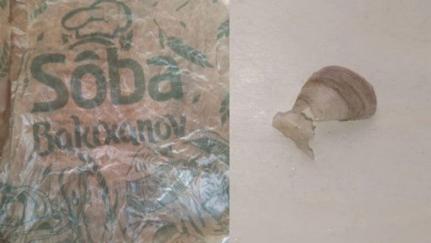 Bakıda növbəti BİABIRÇILIQ &ndash; Çörəyinin içindən çıxan balıqqulağı uşağın damağını kƏSDİ &ndash; FOTO