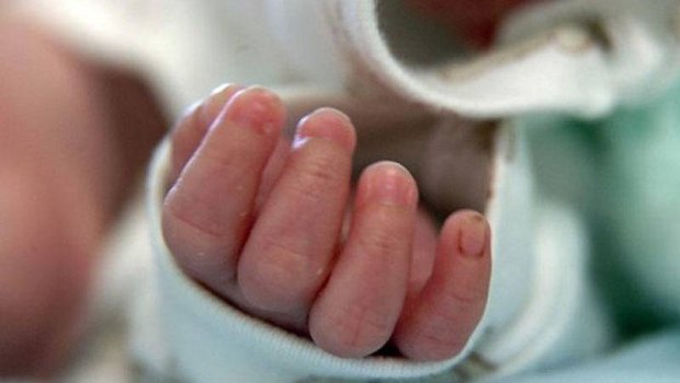 Qubada qeyri-adi görünüşlü körpə doğuldu &ndash; FOTO