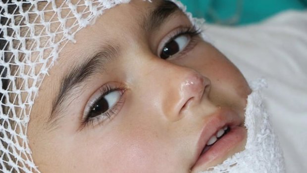 Naxçıvanda doqquz yaşlı uşaq plov qazanına düşdü - FOTO