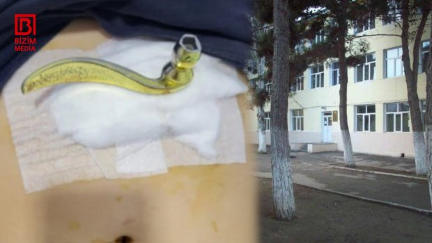 10 yaşlı uşağın qarın boşluğuna qapı dəstəyi məktəbdə BATIB &ndash; Hadisənin TƏFƏRRÜATI