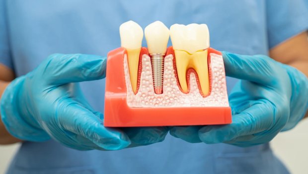 Kabinetlərdə diş çəkilməsi və implant qadağan olunub? &ndash; RƏSMİ AÇIQLAMA