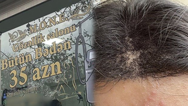 Gözəlləşmək üçün salona gedən qadının başına iş gəldi &ndash; FOTO