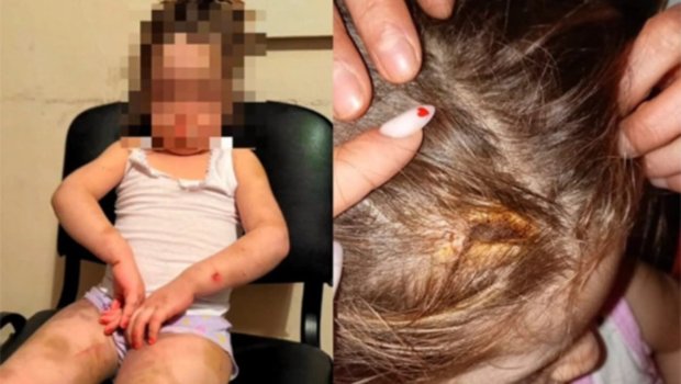 Bakıda ağır işgəncəyə məruz qalan azyaşlı anasından alındı - FOTO