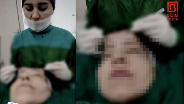 Xəstənin dərisini əlində tutan cərrahla bağlı ARAŞDIRMA BAŞLADI &ndash; VİDEO