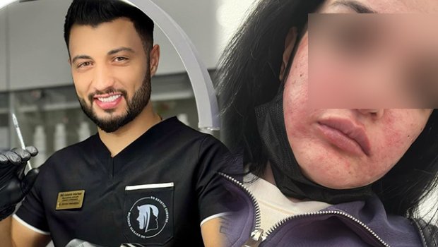 &ldquo;Prosedurdan sonra mənə dedilər ki, o həkim yox, bərbərdir&rdquo;