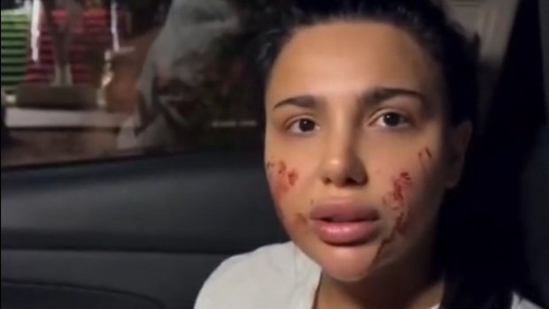 Bakıda sabiq məmurun nəvəsi qadının evinə hücum edib? &ndash;VİDEO