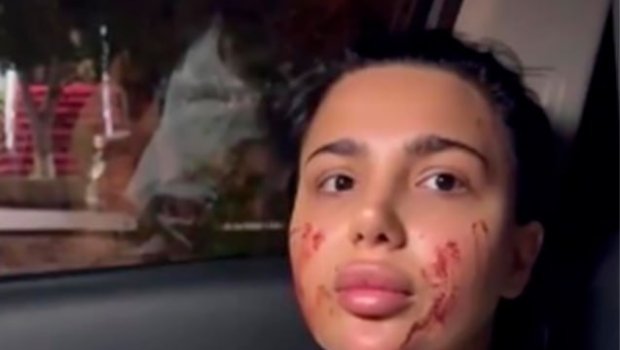 Qadına hücum etdiyi deyilən sabiq məmur nəvəsi saxlanıldı