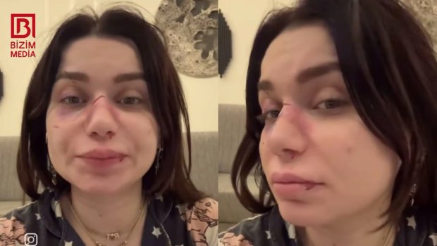 Qadının döyülməsi ilə bağlı görüntülər saxta imiş... &ndash; DETALLAR &ndash; VİDEO