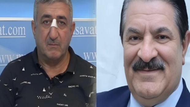 Ağadadaş Ağayevin balta atdığı mühafizəçiyə ŞOK İTTİHAM: Əxlaqsız...