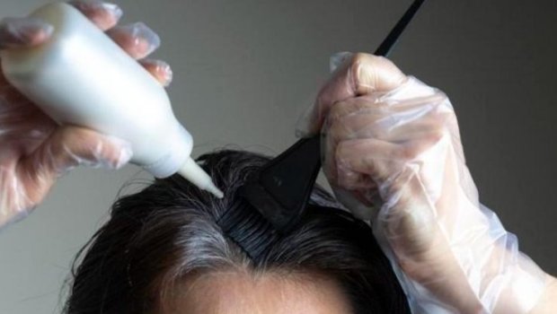 Ağ tüklərdən təbii yollarla qurtulun &ndash; Salona getməyə ehtiyac yoxdur