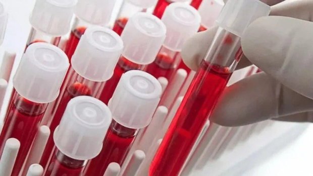 Ən ağıllı insanlar bu qan qrupundan olurlar &ndash; Yapon alimlərinin araşdırması