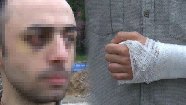 Türkiyədə azərbaycanlı tələbəni döyüb videoya çəkənlərə AĞIR CƏZA &ndash; FOTO