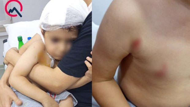 Masazırda 2 yaşlı uşağı it dişlədi – FOTO