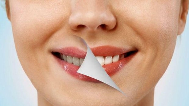 DİQQƏT: Dişlərdəki sarı ləkələr bu xəstəliklərin əlamətidir