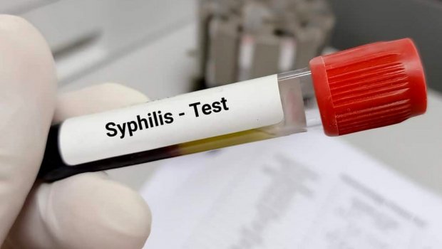 Sifilisə yoluxanların sayı AÇIQLANDI – Uşaqlar da var... – RƏSMİ