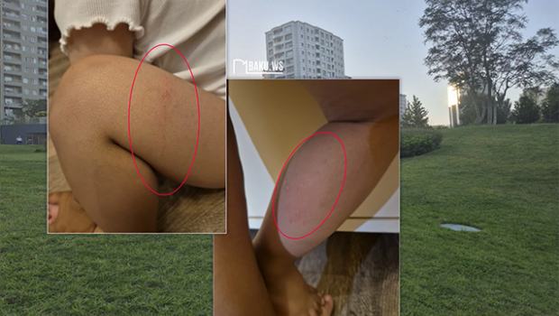 “Mərkəzi Park”da 2 yaşlı uşaq kanalizasiya quyusuna düşdü - Fotolar