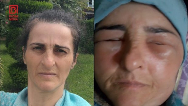 Lənkəranda qonşular arasında dava: Fiziki qüsurlu qadın xəsarət aldı – FOTO