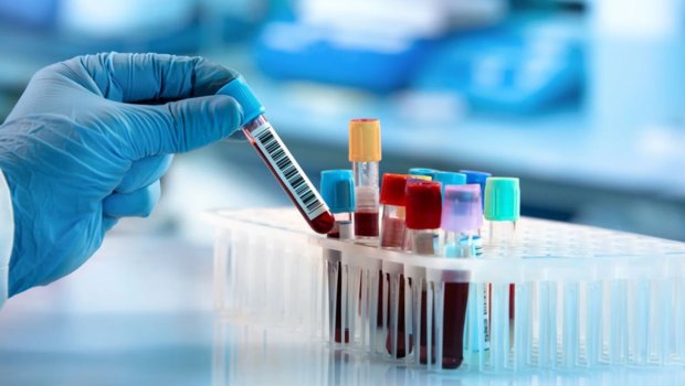 “İtkin düşənlərin yaxınlarından 11 mindən çox bioloji nümunə götürülüb”