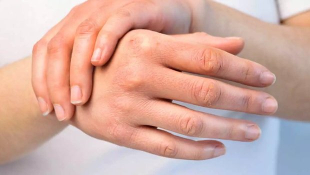 Payızda dərini quruluqdan necə qorumaq olar?