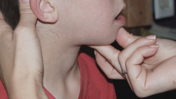 “Çöp” qalma MİFİ – Müasir tibb YOX, xalq ÜSULU?