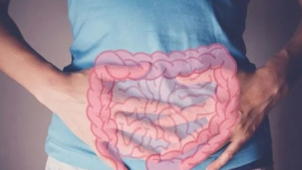 Adı çəkilən məhsullar bağırsaq xərçəngi riskini 17 faiz azaldır