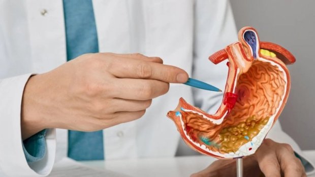 Mədəkiçiltmə əməliyyatı etdirənlərə XƏBƏRDARLIQ