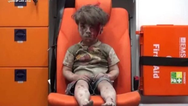 9 il əvvəl hamını məyus etmişdi - İndiki halı diqqət çəkdi - FOTO