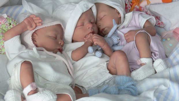 Qubada 20 yaşlı ana üçəm dünyaya gətirdi &ndash; Vaxtından əvvəl doğulan körpələrin SON DURUMU 