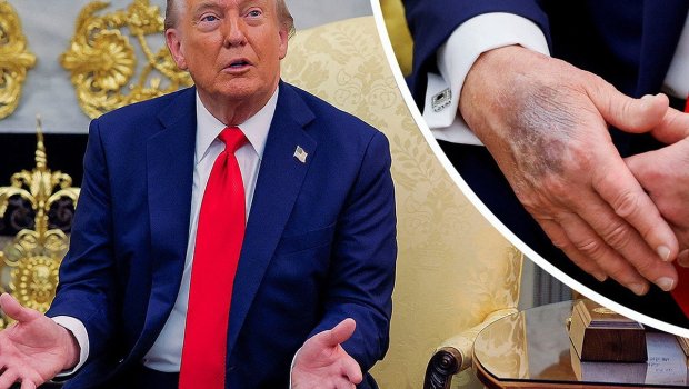 Tramp etiraf etdi: Əlini makiyaj edir &ndash; FOTO