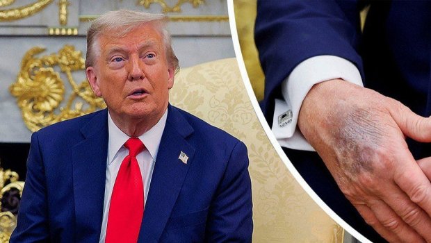 Tramp etiraf etdi: Əlini makiyaj edir &ndash; FOTO