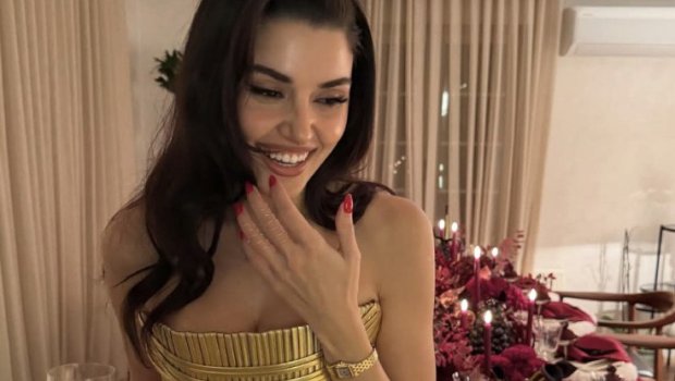 Qolundakı saatın 1,6 milyon qiyməti var - FOTO