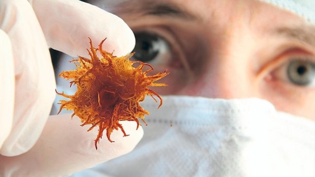 4 növ xərçəngin əsas səbəbi AÇIQLANDI