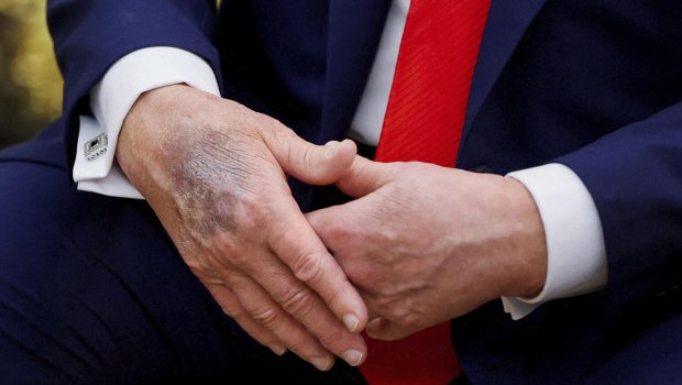 Yenə əlləri ilə gündəm oldu