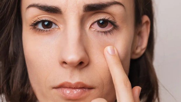 Telefonla çox oynayanların gözü TƏHLÜKƏDƏDİR