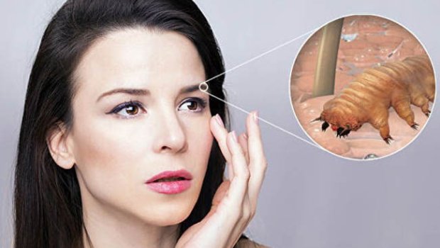 Sinir sistemini məhv edən HƏŞƏRAT - Havalar istiləşdikcə artırlar