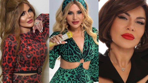 Öz saçı olmadığını etiraf etdi - FOTO