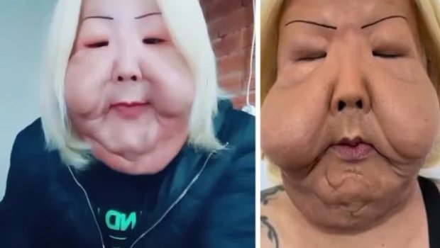 Gözəl olmaq istədi, tanınmaz hala düşdü &ndash; ŞOK FOTOLAR