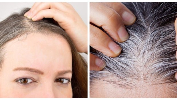 Ağ saçları yox edib yenidən çıxmasını əngəlləyən 9 TƏBİİ VASİTƏ