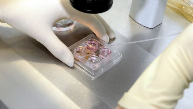 &ldquo;Uşaq bilmir ki, atası kimdir&rdquo; &ndash; Süni mayalanma ilə bağlı QORXUNC XƏBƏRDARLIQ