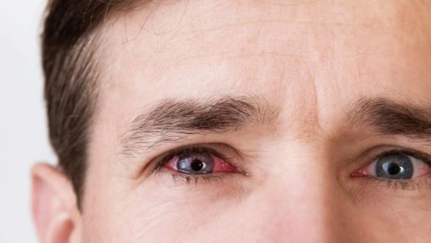 Kişinin gözündən metal parçası çıxarıldı &ndash; FOTO