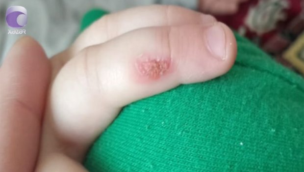 Bakıda tərbiyəçi 3 yaşlı uşağın əlinə dağ basıb &ndash; İDDİA/VİDEO