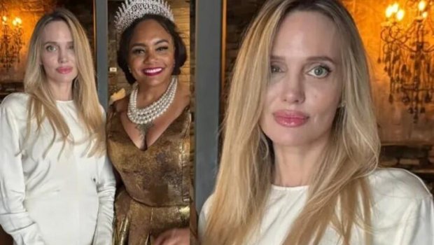 Colinin gözünə nə olub? - FOTO