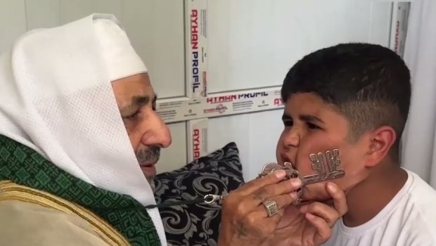 Uşaqların ağzına açar qoymaqla sağaldan kişi sosial mediada viral oldu - VİDEO