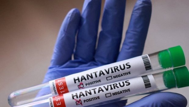 Hantavirusun hansı heyvandan keçdiyi BİLİNDİ &ndash; Bu ölkələrdə olur - FOTO