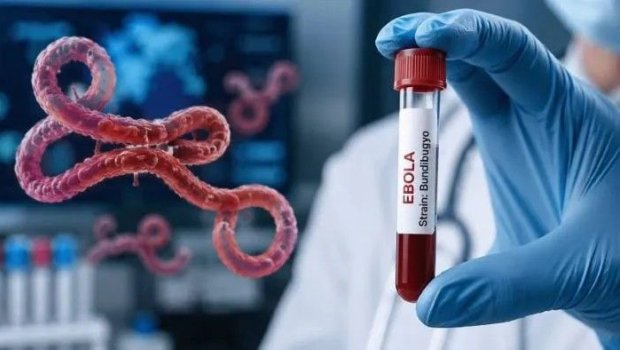 Konqoda yayılan Ebola ştamı artıq sərhədləri AŞIR