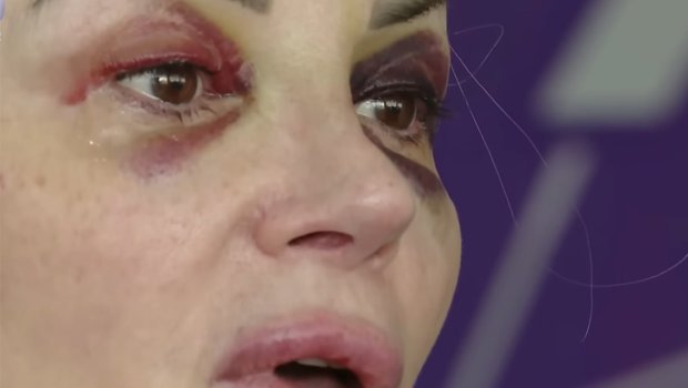 &ldquo;Mən ondan həmişə qorxmuşam...&rdquo;- Həmin kişi eks-iş yoldaşı imiş &ndash; Video